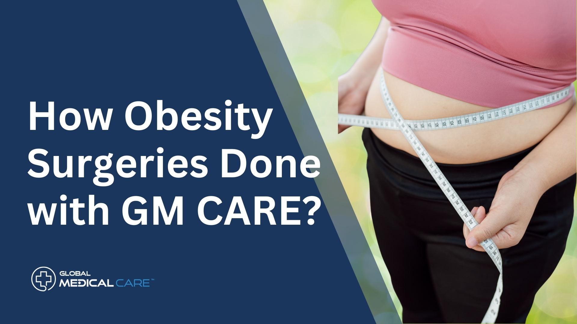 Obesity Surgeries Done with GM CARE
