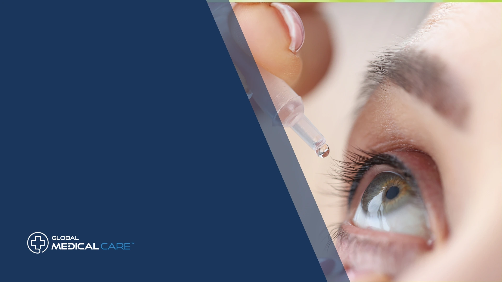 LASIK-Augenoperation Truthahn