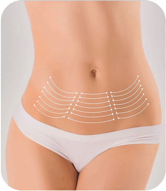 post bariatric surgery turkey