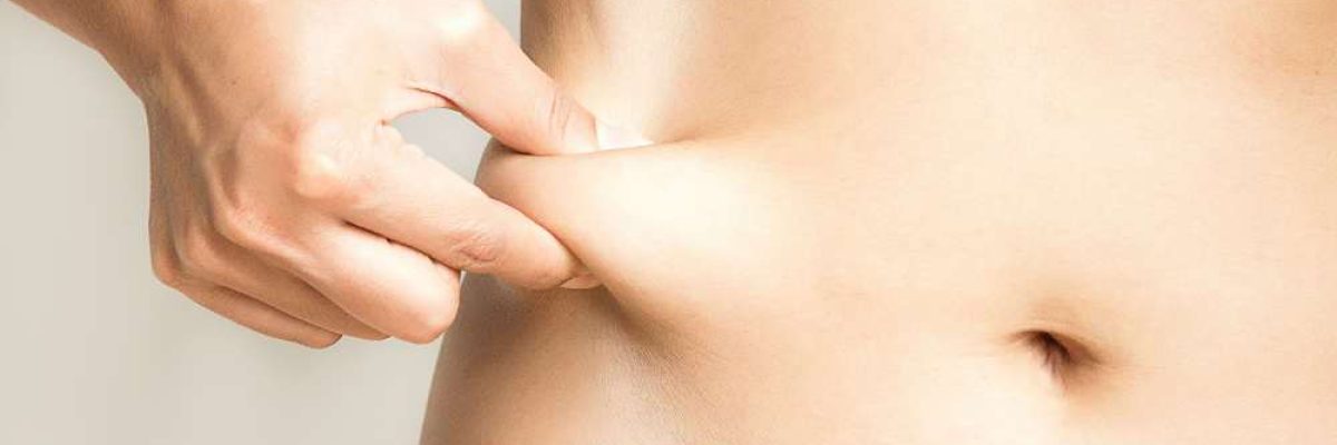 Fat-Reduction-Treatment