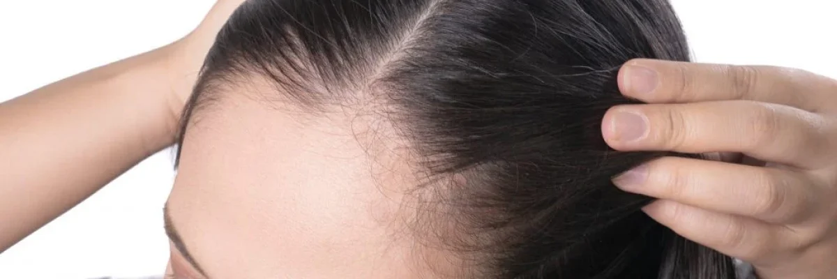 Some of the most common causes of hair loss include genetics, hormonal imbalances, medical conditions, stress, and certain medications. 