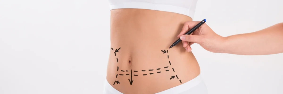 Abdominal Surgery Types
