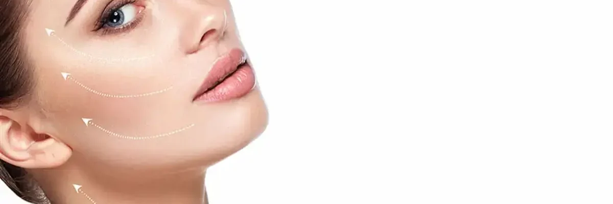 Recovery after facelift surgery