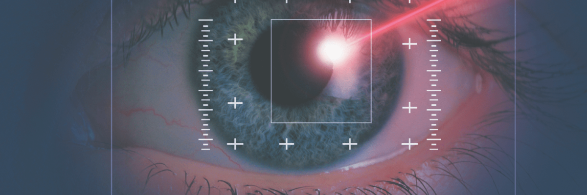 eyer-laser-surgery-min