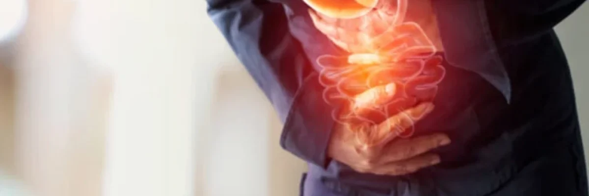 GERD after gastric sleeve surgery