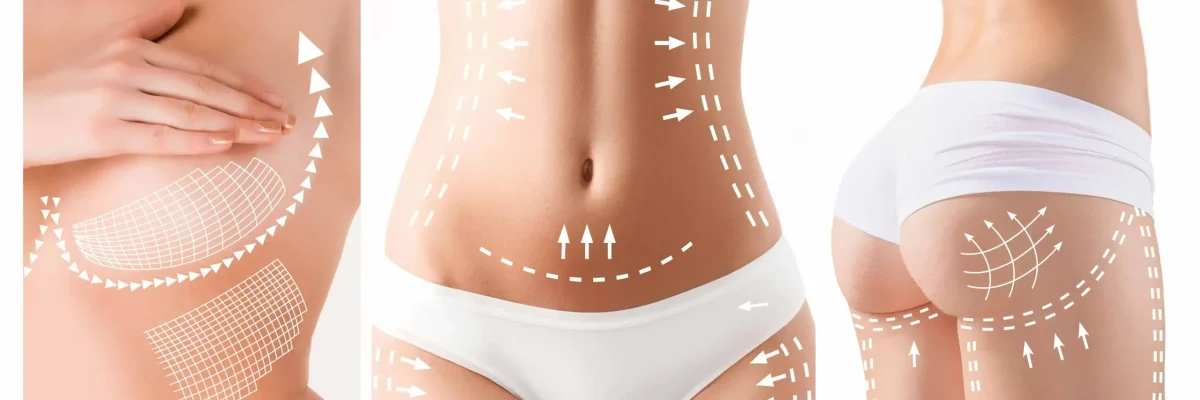 The Mummy Makeover Procedure