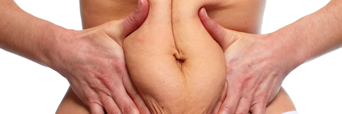 Turkey Weight Loss Surgery